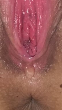 Self lubricating anus